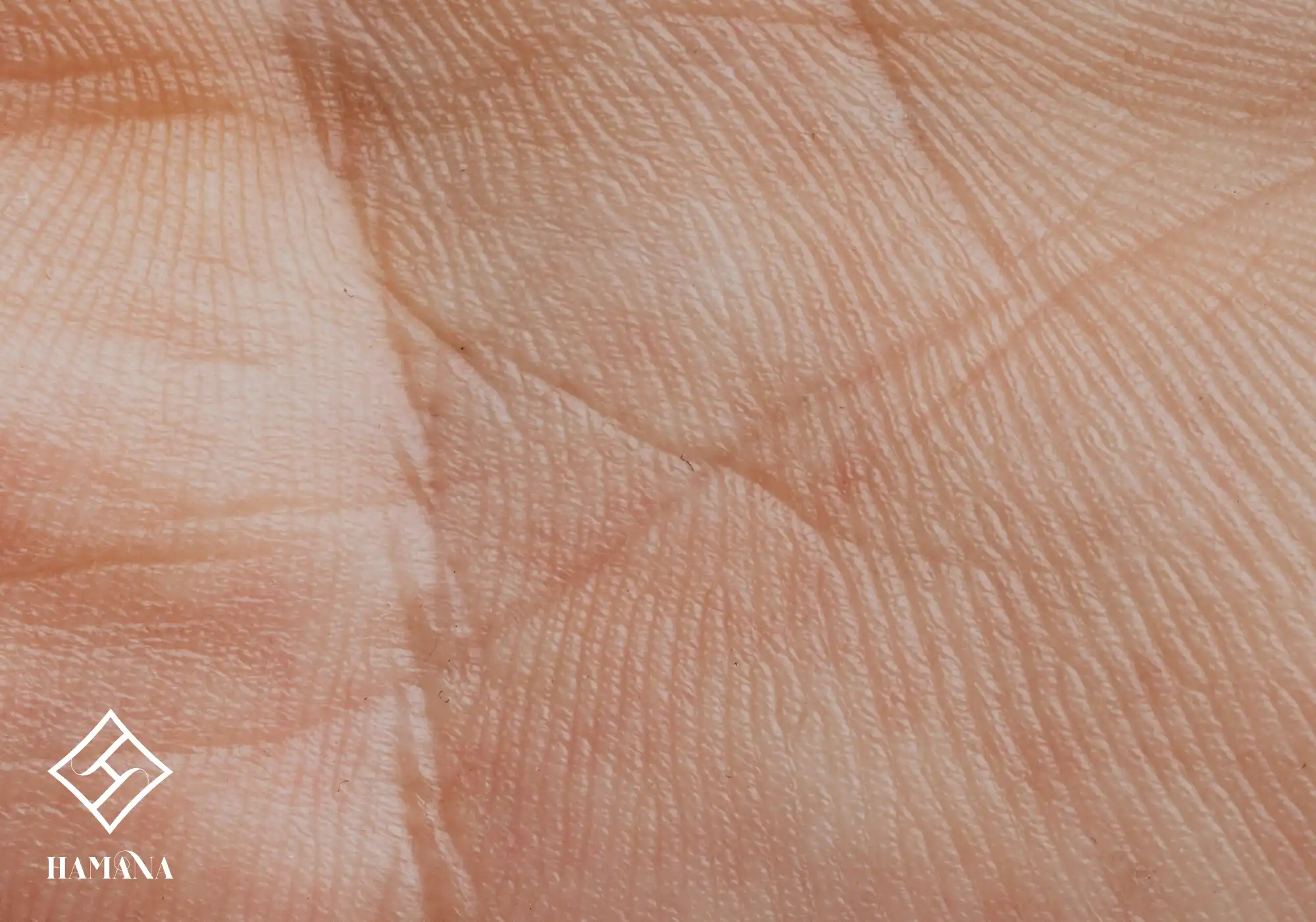 پوست کف دست