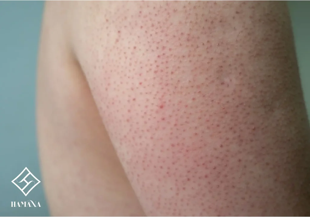 مشکل پوست مری