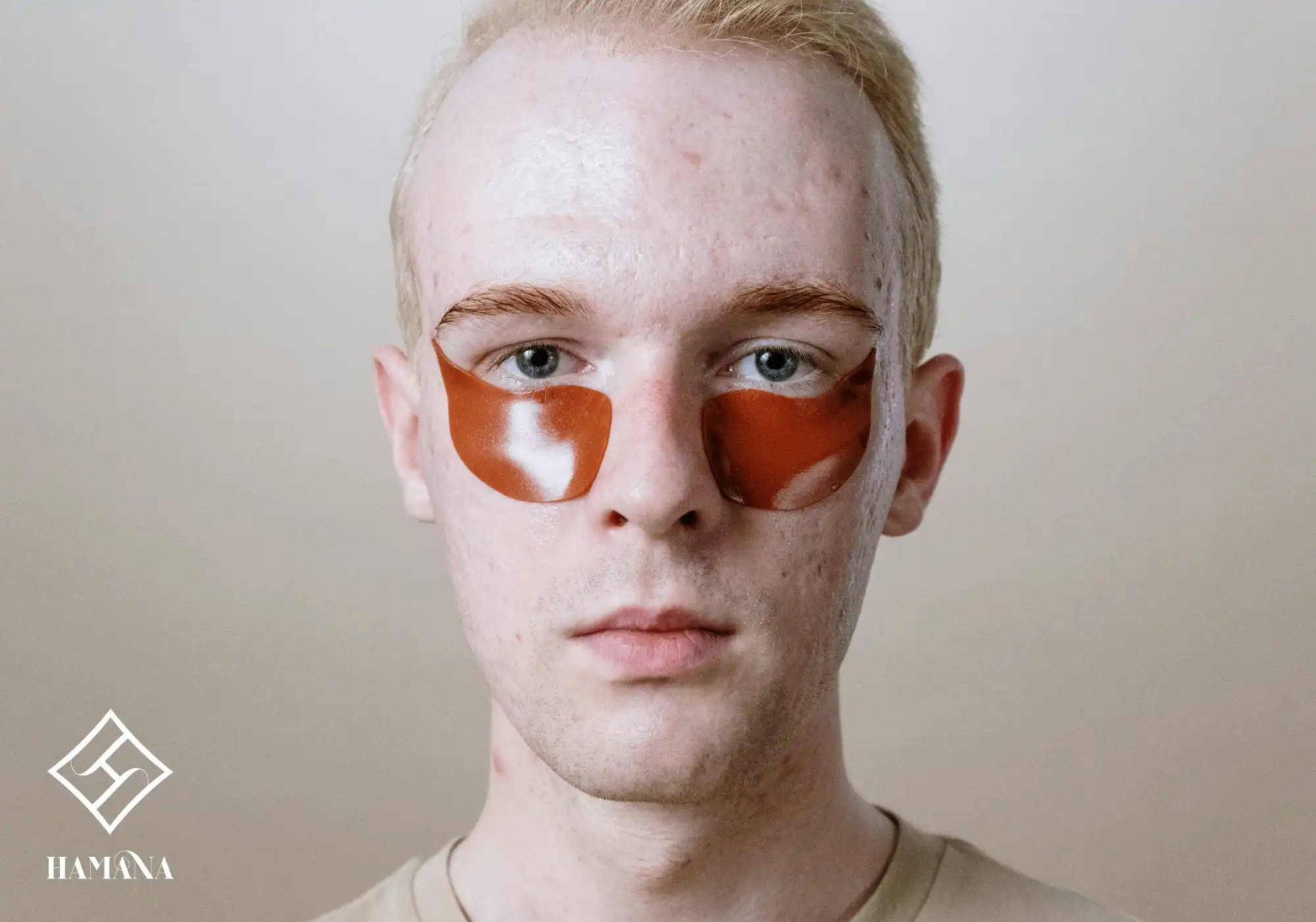 پسری با جوش و آکنه درحال مراقبت از پوست