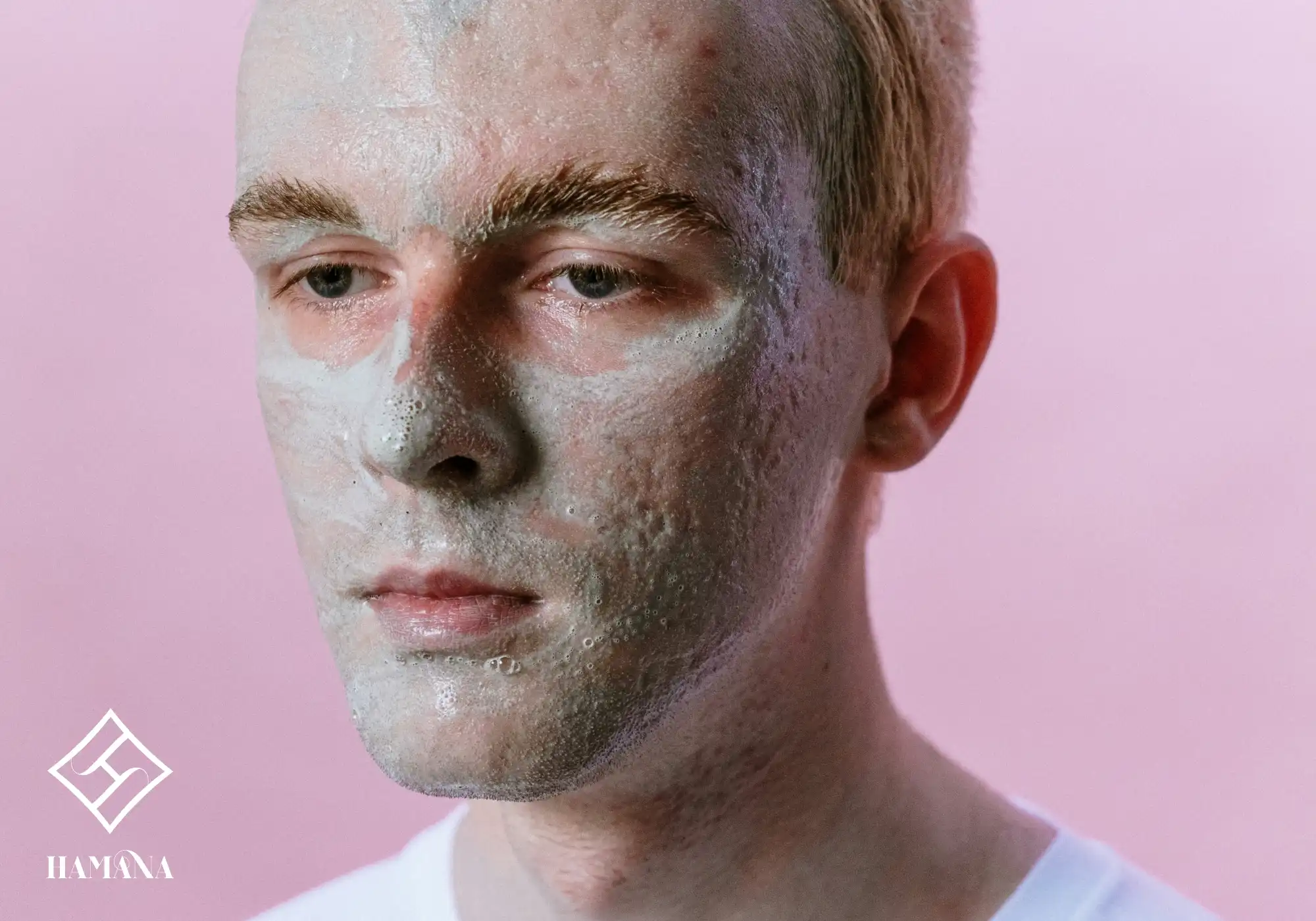 پسری با آکنه درحال استفادهه از ماسک پوستس