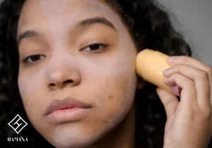 صوتی پر از جوش و آکنه درحال درمان