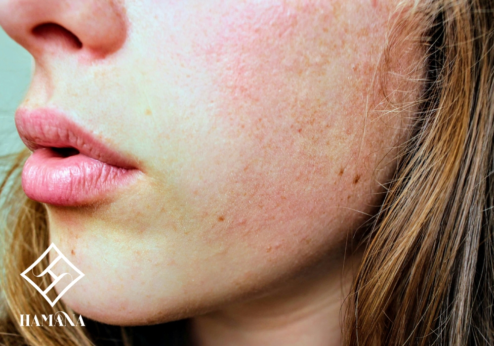 روتین روزانه پوست خشک