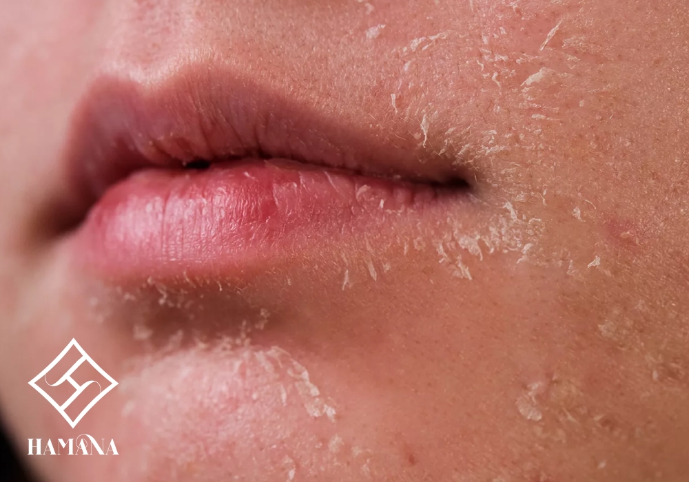 روتین روزانه پوست خشک