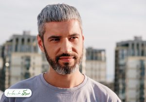 سفیدی زودرس مو
